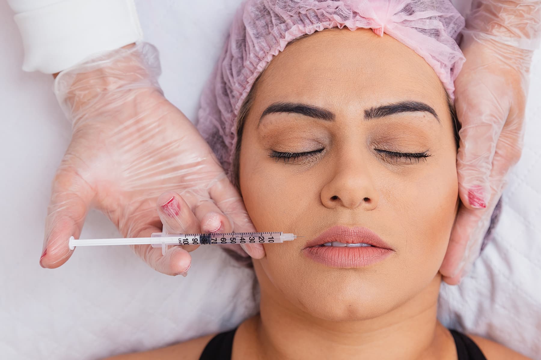 Dermal Fillers in Grand Bay, AL