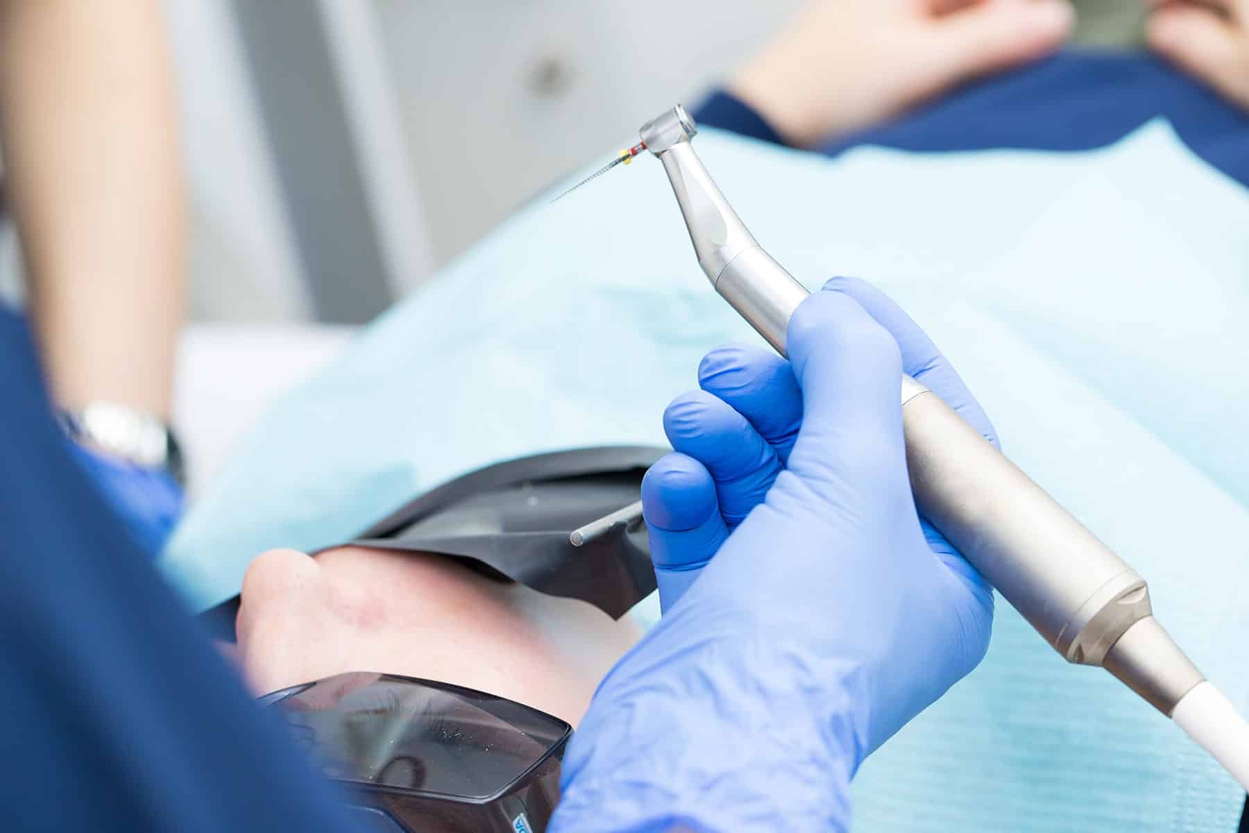 Root canal dentist in Grand Bay, AL