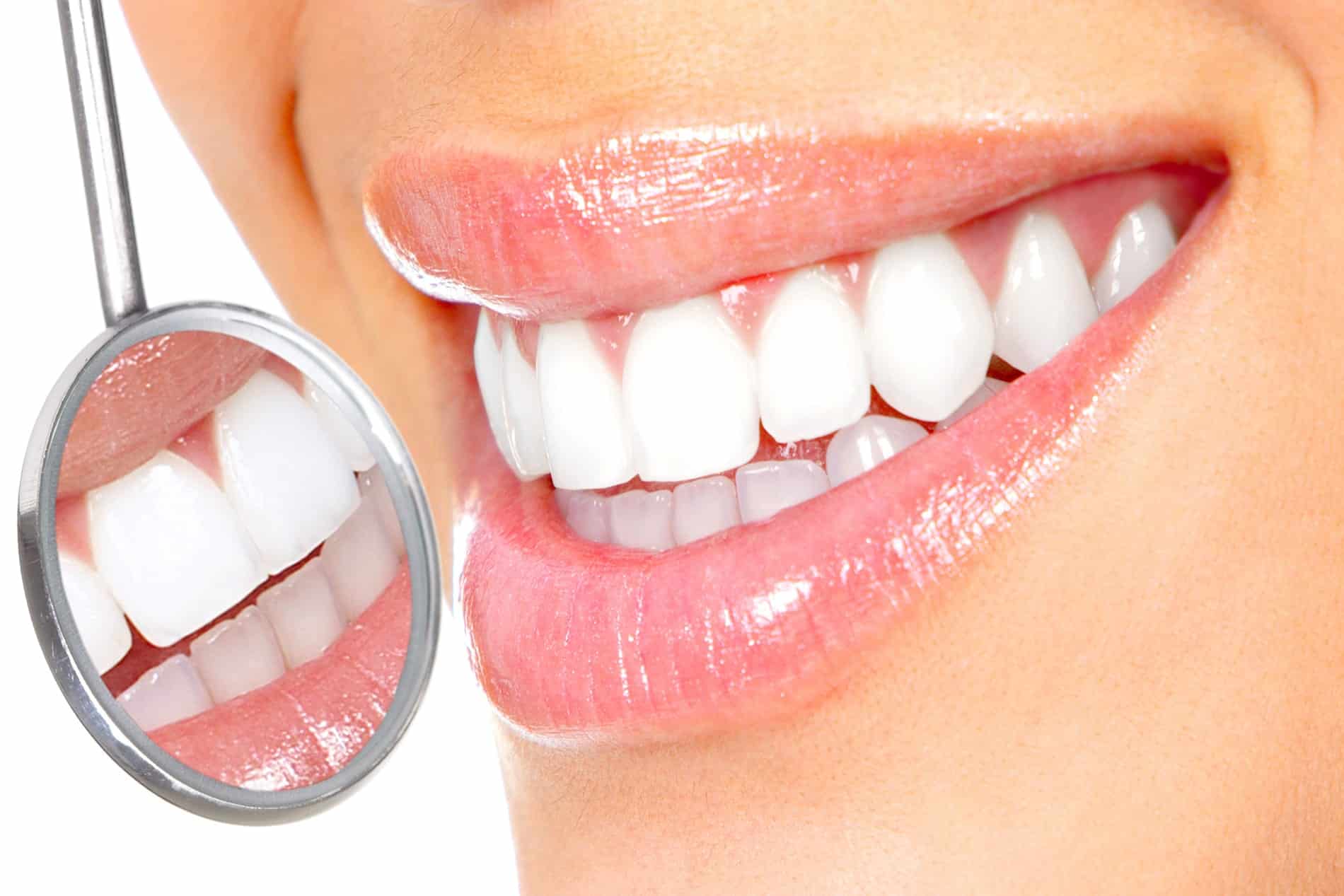 cosmetic teeth whitening treatment at Grand Bay Dental Spa in Grand Bay AL