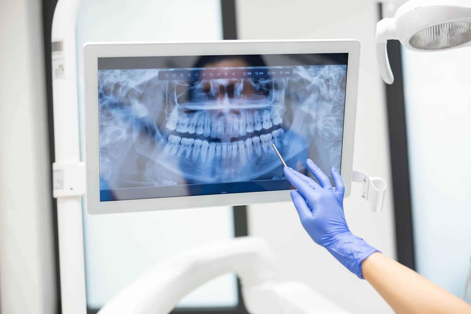 Schedule an Oral cancer screening in Grand Bay, AL